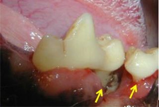 The above photo is a dog with advanced periodontal disease causing gum recession and bone loss of his right lower first and second molars.